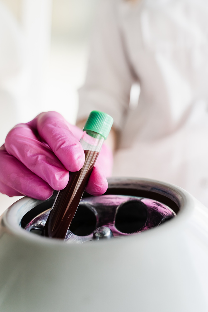 Close-up inserting test tube with blood in centrifuge to get plasma of patient girl for PRP Platelet Rich Plasma procedure. Platelet Rich Plasma PRP for improves skin volume and texture.